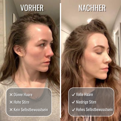 Carvenchy Haaröl - Volles und gesundes Haar nach nur 3 Monaten