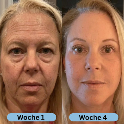 VoluFine - Koreanisches Kollagen-Serum für reife Haut