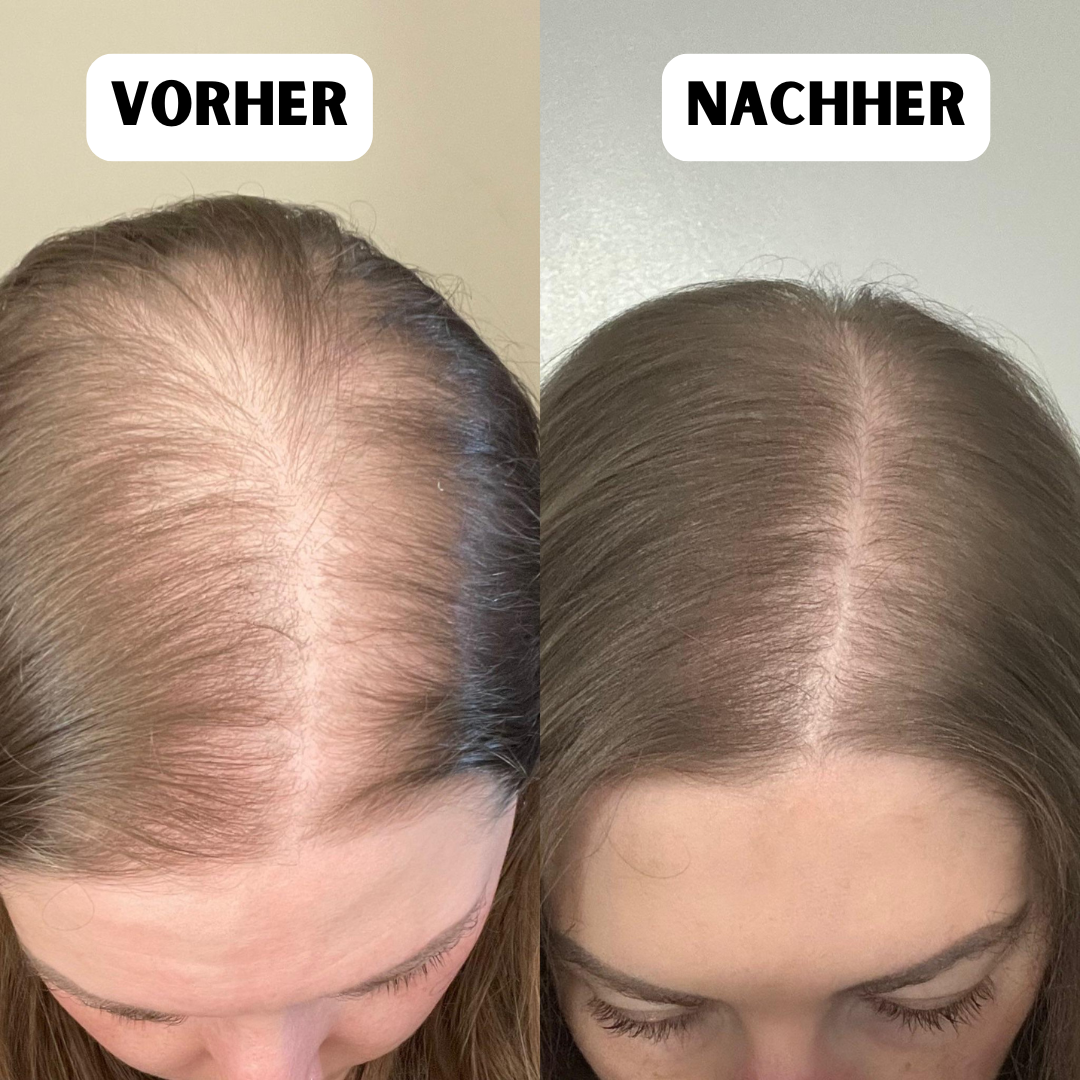Selbstbewusstsein zurück