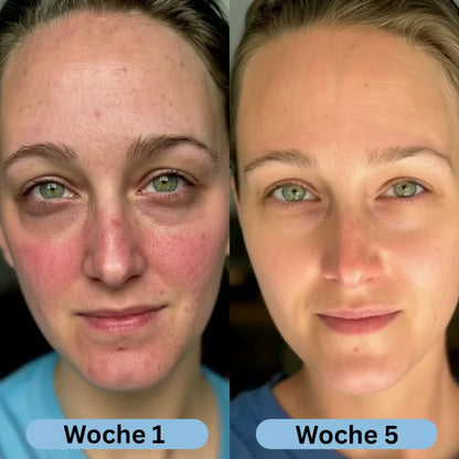 VoluFine - Koreanisches Kollagen-Serum für reife Haut