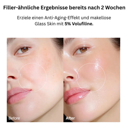 VoluFine - Koreanisches Kollagen-Serum für reife Haut