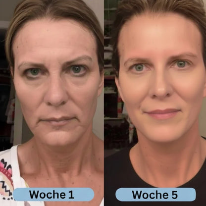 VoluFine - Koreanisches Kollagen-Serum für reife Haut