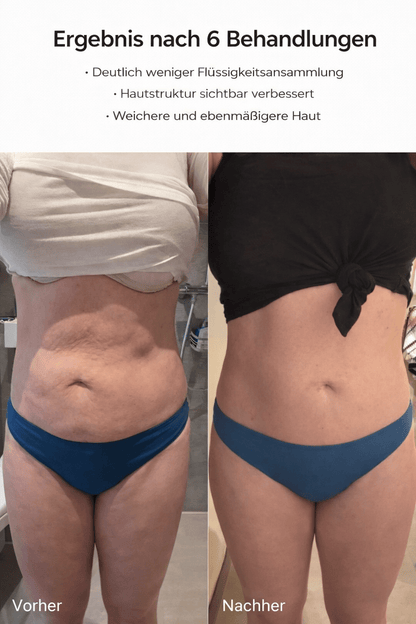 Celluviaa – glatte Haut in 14 Tagen