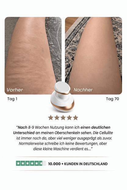 Celluviaa – glatte Haut in 14 Tagen